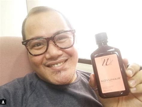 [Review] Satisfied with My Ongoing Novuhair Journey.
